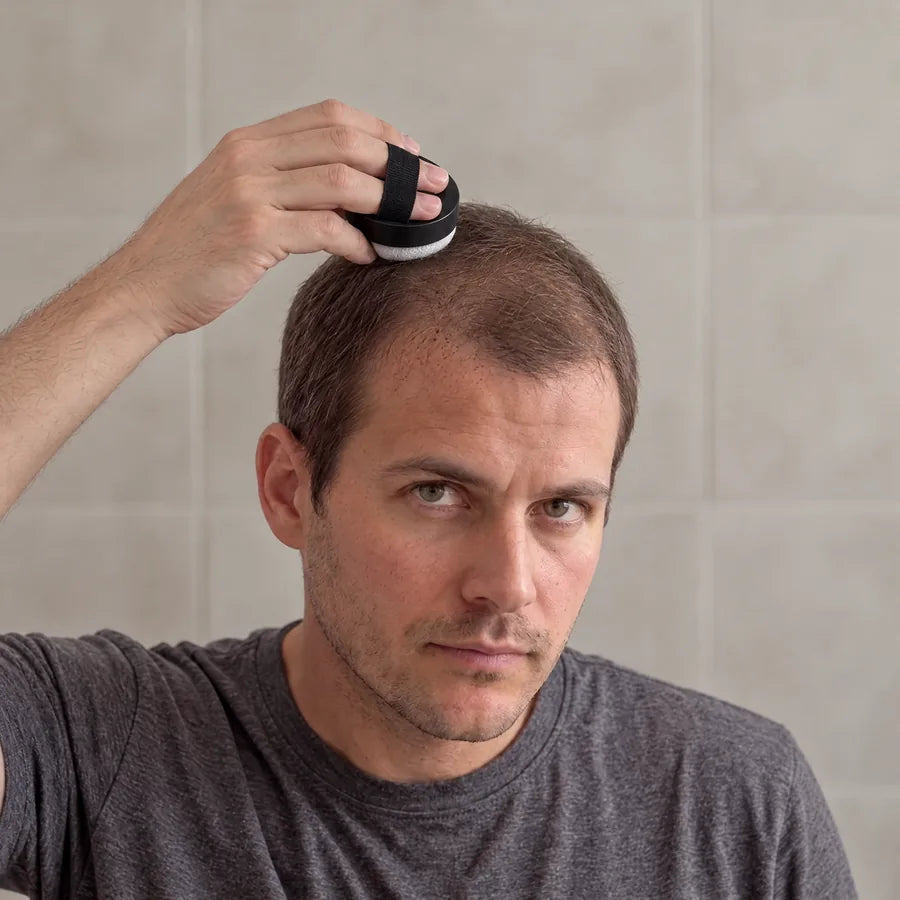 Dab onto thinning areas