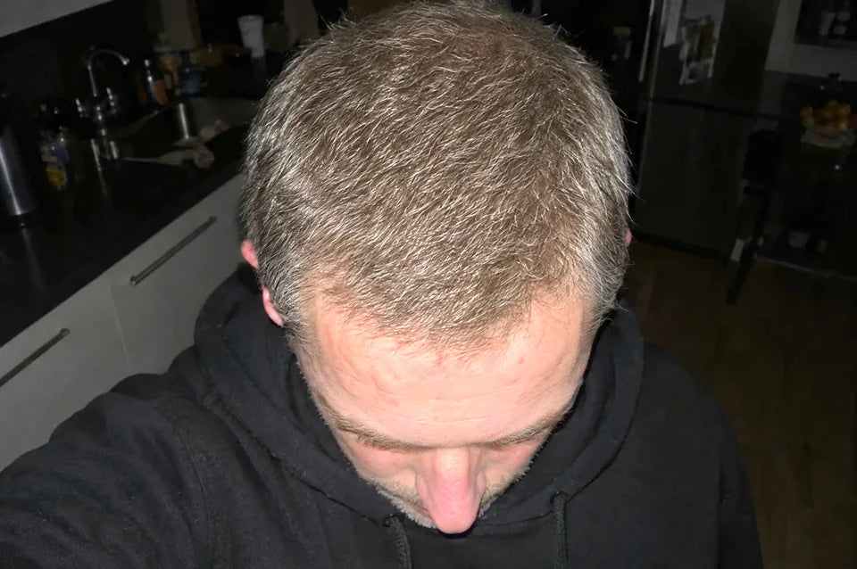 Après